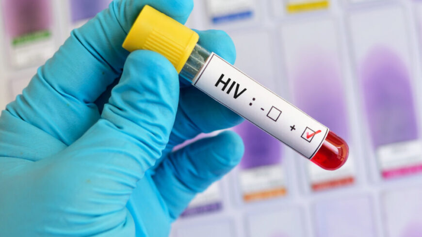 Tack vare forskning har man kunnat se positiv effekt med läkemedel som kan förebygga HIV. Foto: Getty Images